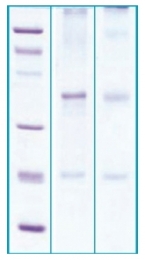 AR03045PU-N - CTGF