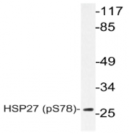 AP20847PU-N - HSPB1 / HSP27