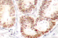AP20851PU-N - MAP kinase p38
