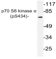 AP20852PU-N - RPS6KB1 / STK14A