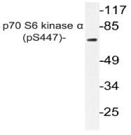AP20854PU-N - RPS6KB1 / STK14A