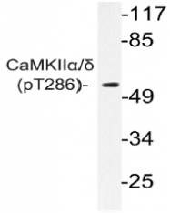 AP20855PU-N - CAMK2A/2D