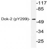 AP20861PU-N - DOK2 / p56 dok2