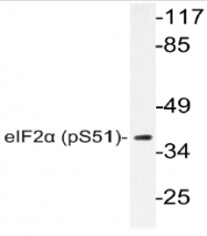 AP20862PU-N - EIF2A / EIF2S1