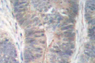 AP20863PU-N - EIF2AK2 / PKR