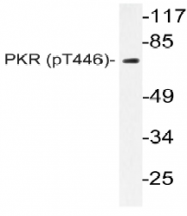 AP20864PU-N - EIF2AK2 / PKR