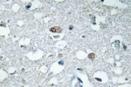 AP20870PU-N - Synapsin-1