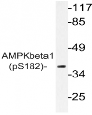 AP20874PU-N - AMPK beta-1 chain / AMPKb