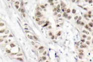 AP20877PU-N - BRCA1 / RNF53