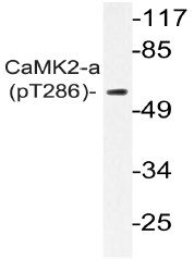 AP20879PU-N - CAMK2A