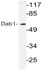 AP20741PU-N - DAB1