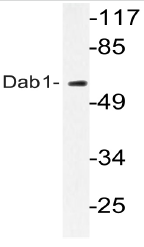 AP20742PU-N - DAB1