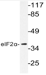 AP20746PU-N - EIF2A / EIF2S1