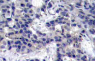 AP20748PU-N - EIF2AK2 / PKR