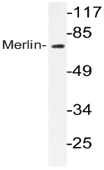AP20757PU-N - Merlin