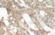 AP20760PU-N - PRKCQ / PRKCT
