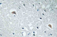 AP20761PU-N - Synapsin-1