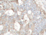 AP20737PU-N - Cortactin