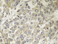 AP20734PU-N - RPS6KB1 / STK14A