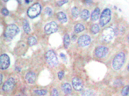 AP20733PU-N - RPS6KB1 / STK14A