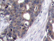 AP20732PU-N - RPS6KB1 / STK14A
