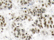 AP20730PU-N - MAPK8 / JNK1