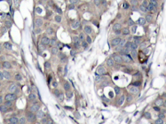 AP20728PU-N - HSPB1 / HSP27