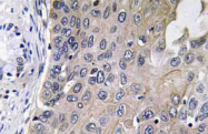 AP20764PU-N - Guanylate cyclase soluble GUCY1A3