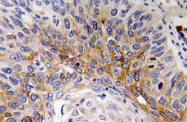 AP20766PU-N - Cardiotrophin-1