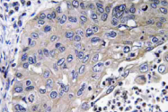 AP20767PU-N - Cathepsin D