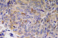 AP20770PU-N - Interleukin-32 / IL32