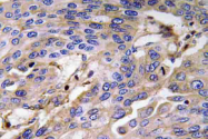 AP20774PU-N - Haptoglobin
