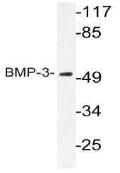 AP20776PU-N - BMP3