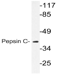 AP20778PU-N - Pepsinogen group II