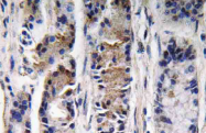 AP20778PU-N - Pepsinogen group II