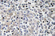 AP20783PU-N - Interleukin-16 / IL16