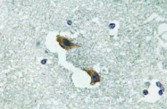 AP20788PU-N - ATP7A