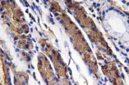 AP20789PU-N - Pepsin