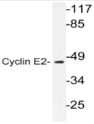 AP20796PU-N - Cyclin E2