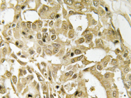 AP20706PU-N - Catenin beta-1