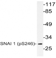 AP20798PU-N - SNAI1