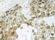 AP20703PU-N - NFKBIA / IKBA