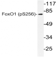 AP20803PU-N - FOXO1A