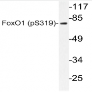 AP20804PU-N - FOXO1A
