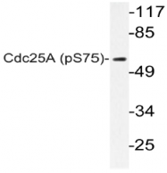 AP20807PU-N - CDC25A