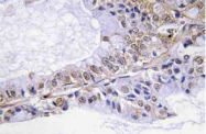 AP20808PU-N - Cofilin-1