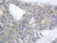 AP20690PU-N - Paxillin / PXN