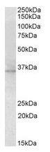 AP21505PU-N - RDH5 / RDH1