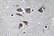 AP20664PU-N - Neuropeptide Y / NPY