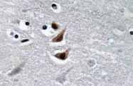 AP20665PU-N - NDP kinase A